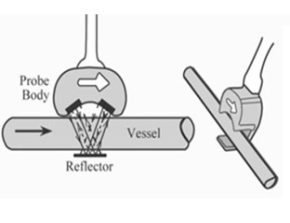 Prinsip Kerja Ultrasonic Flow Meter